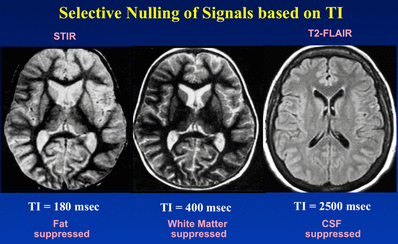 IR selective nulling