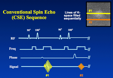 conventional spin echo